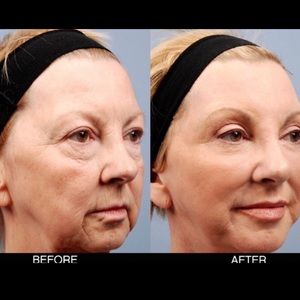 DAY AND NIGHT AGE RECOVERY CREAM SERUMS BOTH 2 OZ